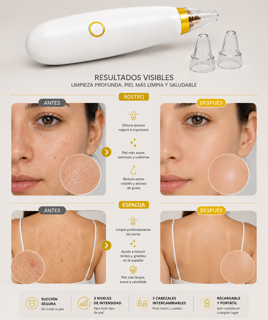 LIMPIADOR FACIAL/ LIMPIADOR DE POROS
